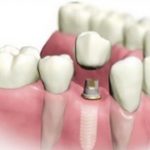 Насущные вопросы зубного здоровья и стоматологии.